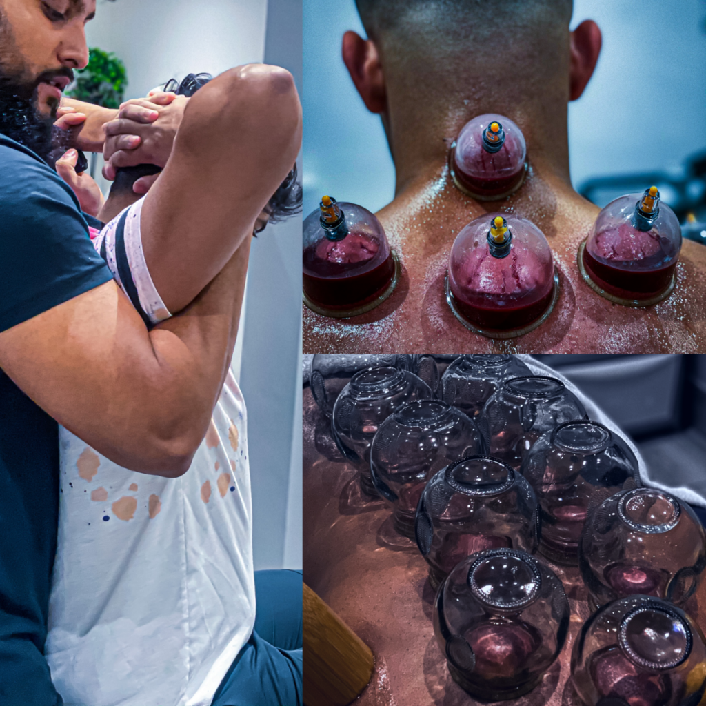Cupping Therapy Coventry