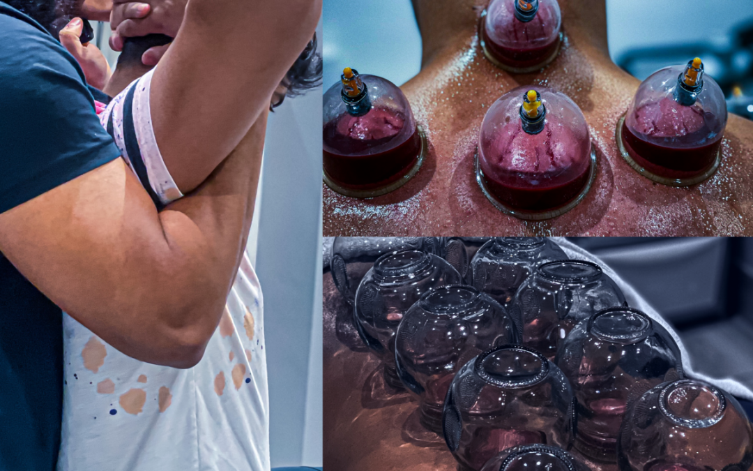 Huge Benefits Of Cupping Therapy