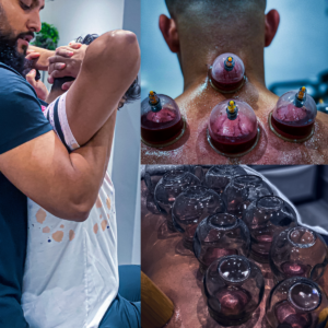 Cupping Therapy Coventry